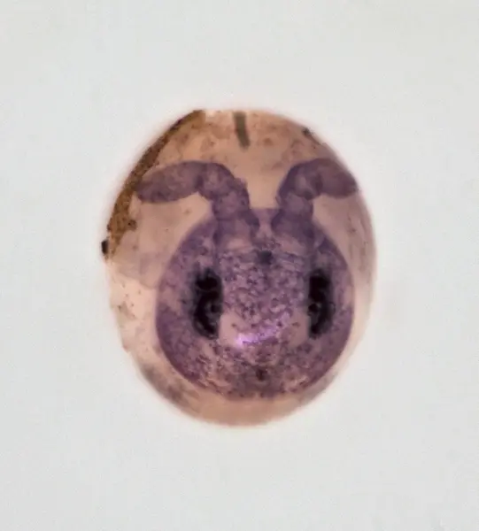 






  
    
  
  
  


Isotoma springtail egg @ 20x with Laowa Aurogon
<br>
<br>


  2025-01-15
  <br>





  ©️2025 Ben Gruver

<br>
License: <a href="https://creativecommons.org/licenses/by-nc/4.0/" style="text-decoration: underline;">CC BY-NC 4.0</a> 






